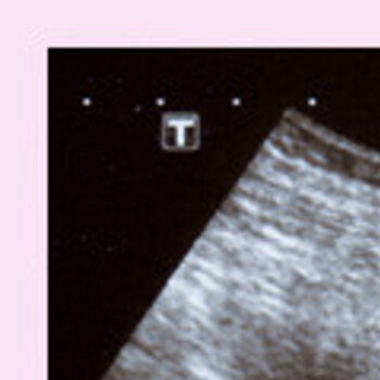 Ультразвуковое исследование: три этапа