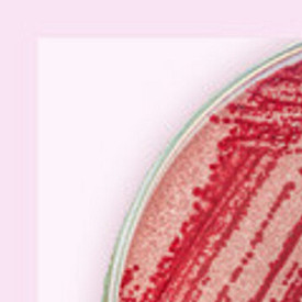 Бактериальный вагиноз