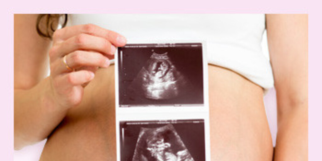26-35 неделя беременности