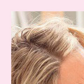 Врач против аллергии