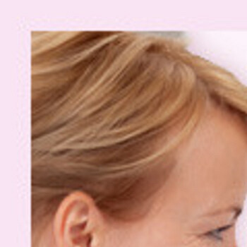 Менингококковая инфекция