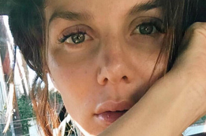 Анна Седокова рассказала, откуда у нее ужасные шрамы и синяки