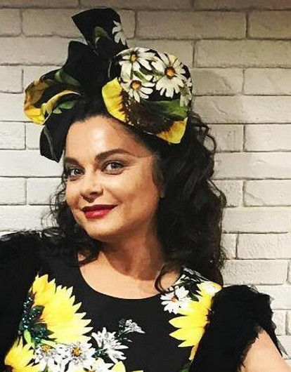 Наташу Королеву обвинили в чрезмерном увлечении пластикой