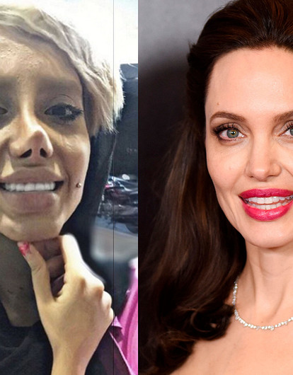 Что сделала с собой эта женщина, чтобы быть похожей на Джоли?