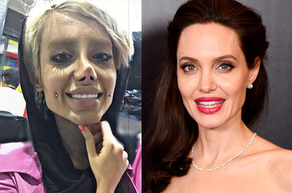 Что сделала с собой эта женщина, чтобы быть похожей на Джоли?