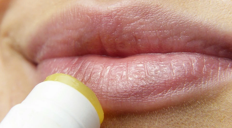 10 способов вылечить герпес на губах самостоятельно
