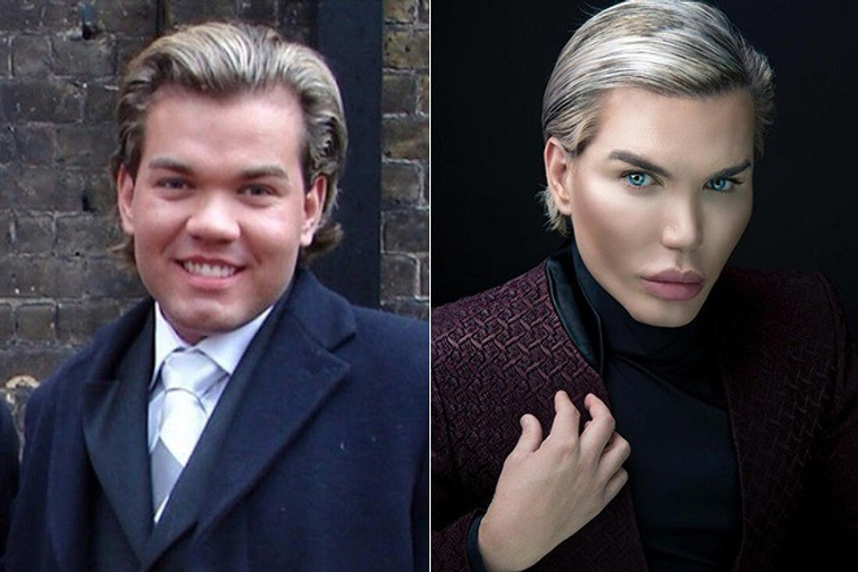 Разница на лицо: снимки Родриго до и после пластических операций.