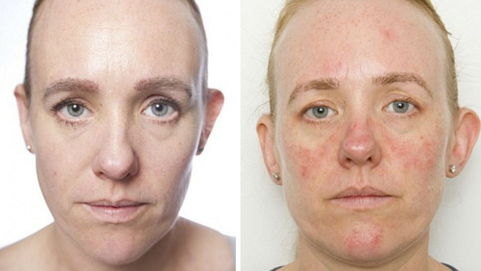 Глубокие морщины и воспаление глаз: как будет выглядеть кожа, если не умываться 30 дней?