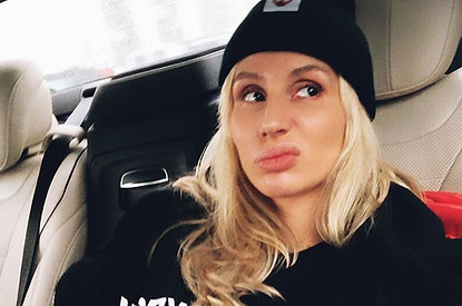 Поклонники обвинили Светлану Лободу в неудачном использовании фотошопа