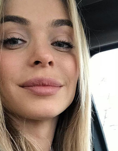 Анна Хилькевич: «Я колю ботокс с 25 лет!»