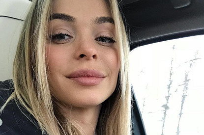 Анна Хилькевич: «Я колю ботокс с 25 лет!»