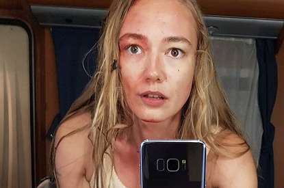 «Импланты что ли?» Оксану Акиньшину заподозрили в пластике