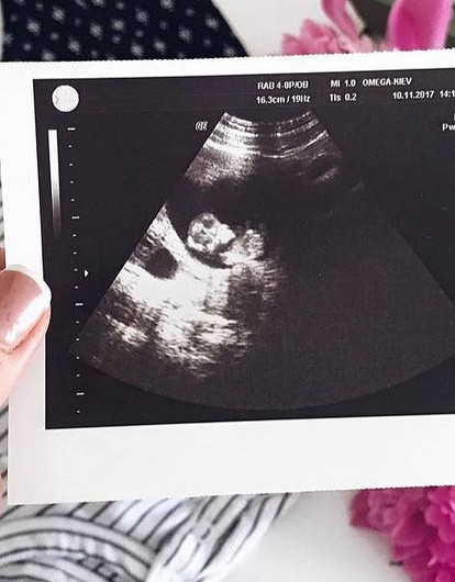 Доплер УЗИ при беременности: что это и зачем его делать