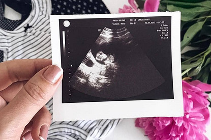 Доплер УЗИ при беременности: что это и зачем его делать