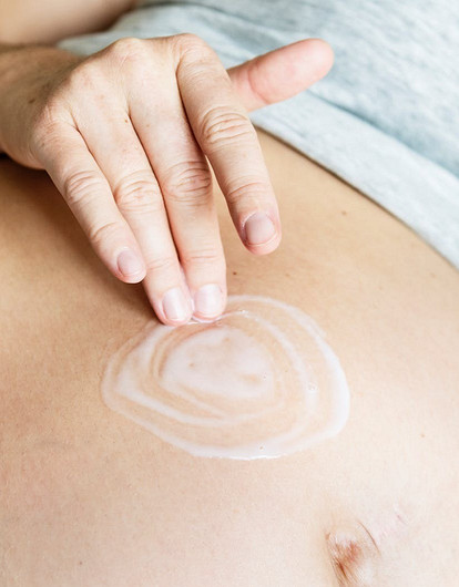 Крем от растяжек для беременных: какой лучше?