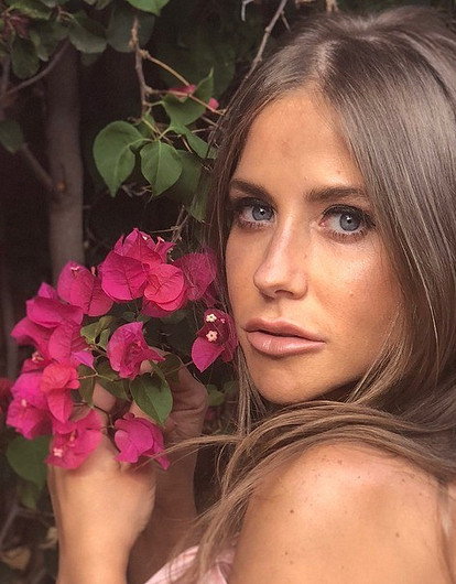 «Что за пятна на лице?»: Юлия Барановская удивила подписчиков снимком без макияжа