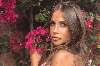 «Что за пятна на лице?»: Юлия Барановская удивила подписчиков снимком без макияжа