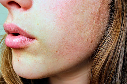 Как подобрать крем от морщин в 25+, 35+ и 45+? Обязательные элементы в составе