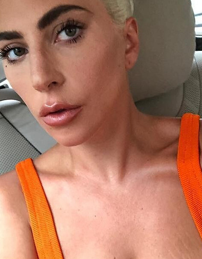 5 звезд, которые не боятся показать растяжки