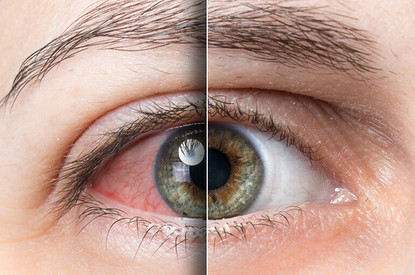 Выбираем глазные капли от конъюнктивита у взрослых