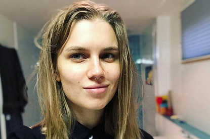 Дарья Мельникова планирует избавиться от растяжек с помощью пластики