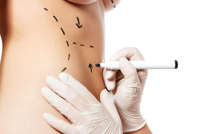 Просвет между ног и изменение голоса: 7 самых трендовых пластических операций в 2019 году