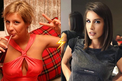 20 фото звезд, доказывающих, что их красота подарена вовсе не природой