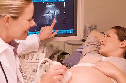 УЗИ во время беременности: ответы на самые популярные вопросы