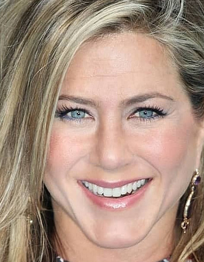 Дженнифер Энистон сделала ботокс и филлеры