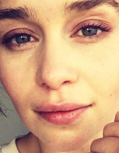 Эмили Кларк рассказала, как перенесла три операции и чудом выжила