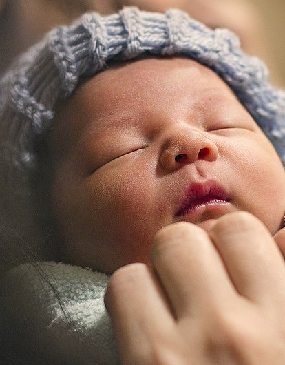 Диатез на щеках у ребенка: лечение, симптомы и профилактика