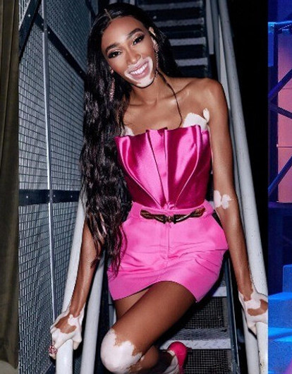 «Садись, два!» Худшие наряды звезд за прошедшую неделю