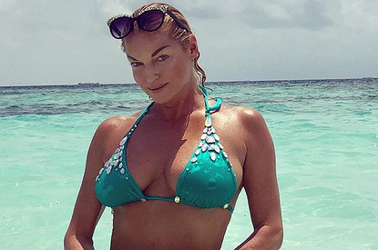 Анастасия Волочкова напугала подписчиков окровавленной ногой (ни дня без приключений)