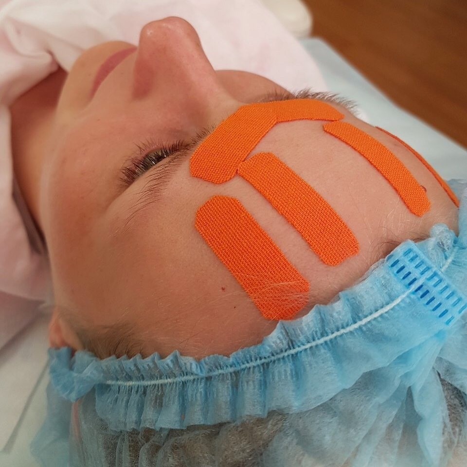 Тейпирование лица: хайповый способ избавиться от морщин