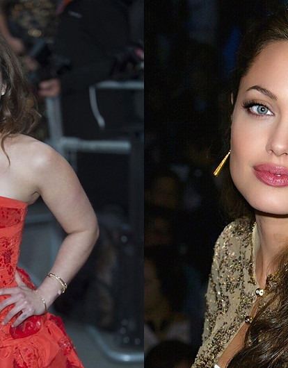 Звезды, которые похудели и стали выглядеть только хуже