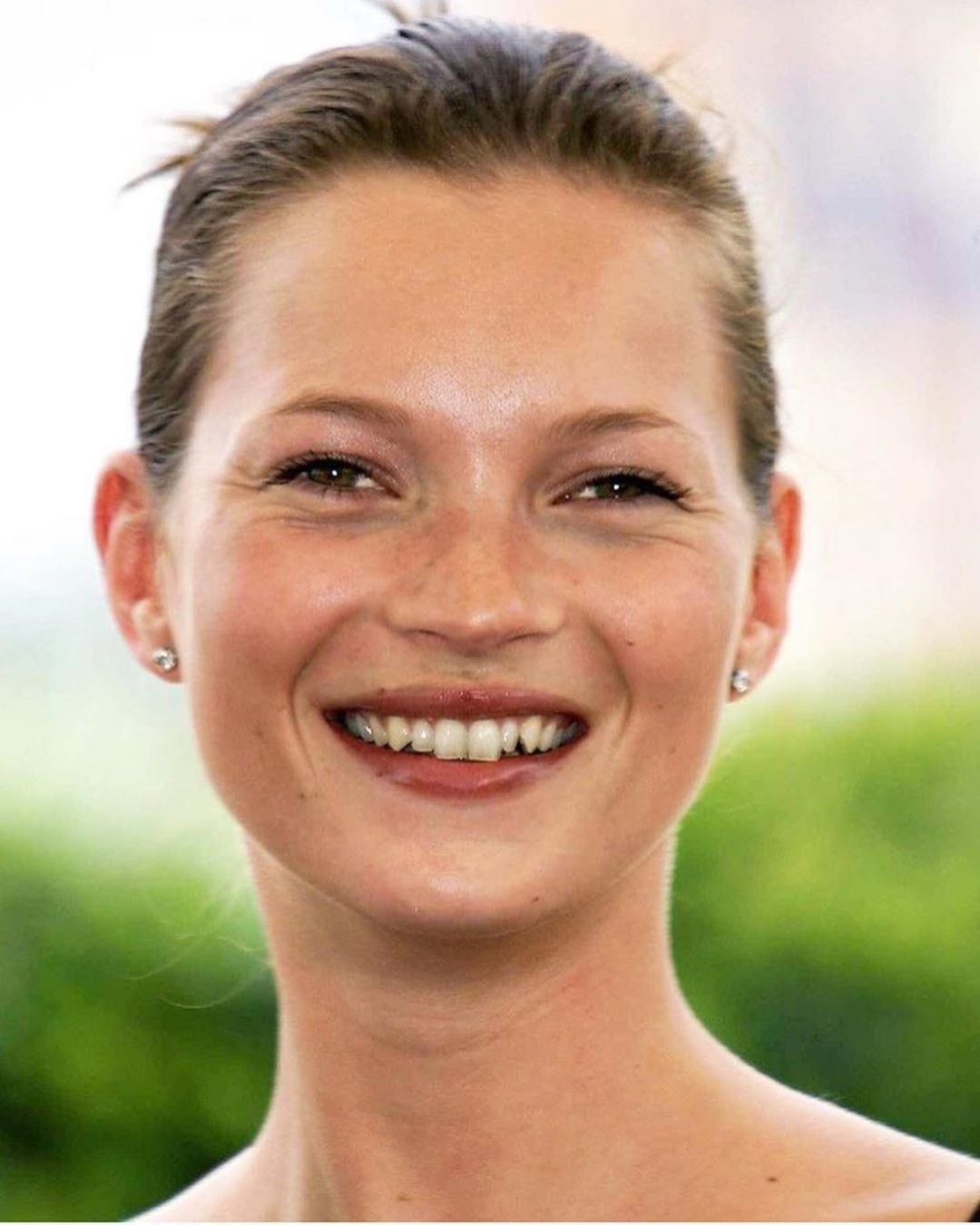 6 звезд, у которых кривые зубы и они не стесняются (уверенность в себе 100 lvl)