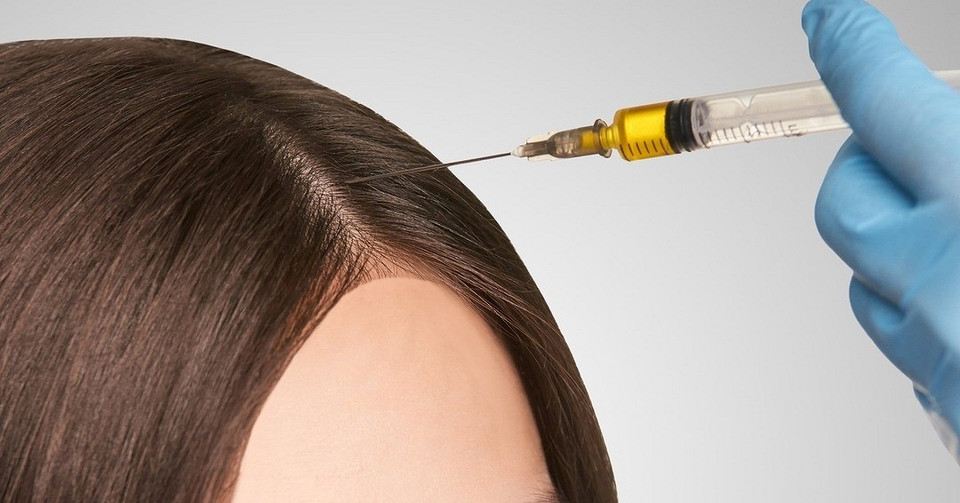 Плазмолифтинг для волос: одна процедура, которая решит все проблемы