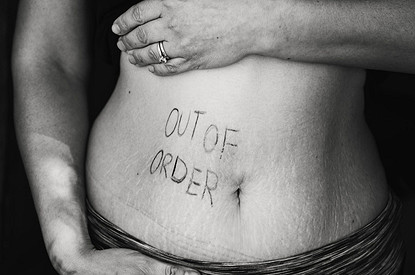 Кофе, аспирин и другие причины язвы желудка (а еще симптомы и лечение)