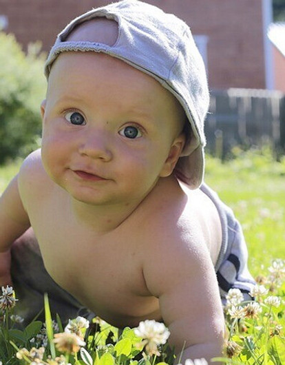 Припекло: симптомы и лечение теплового удара у ребенка