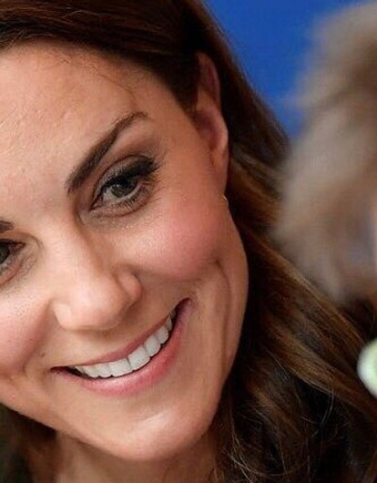 Пластический хирург заявил, что Кейт Миддлтон любит «детский ботокс»