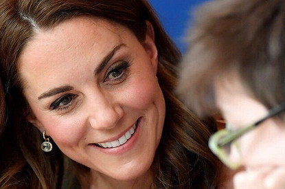 Пластический хирург заявил, что Кейт Миддлтон любит «детский ботокс»