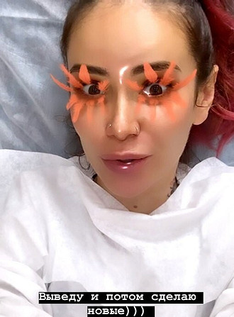 В Instagram Айза Анохина призналась, что посетила косметолога. Она обновила татуаж бровей и решила убрать гиалуроновую кислоту из губ. Результат не заставил себя долго ждать.«Я, конечно,...