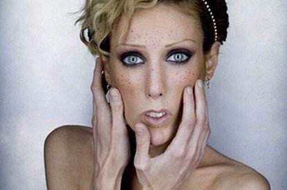 Звезды, которые умерли от анорексии