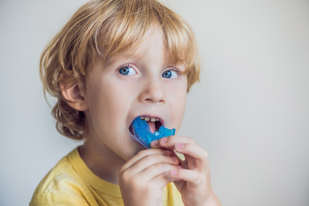 Исправление прикуса у детей: возможности современной стоматологии