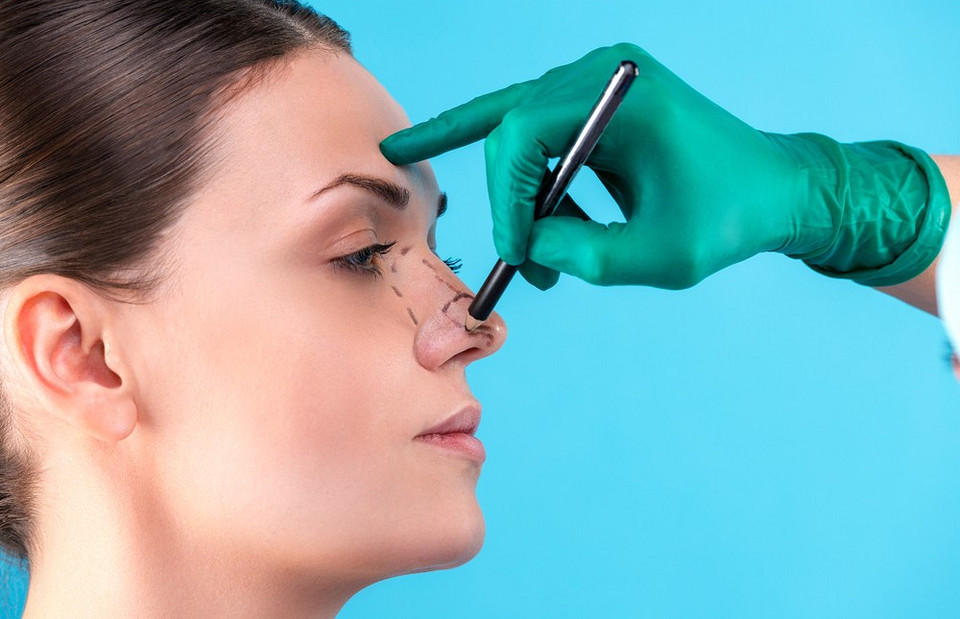 Как делают ринопластику носа: виды и уход после операции
