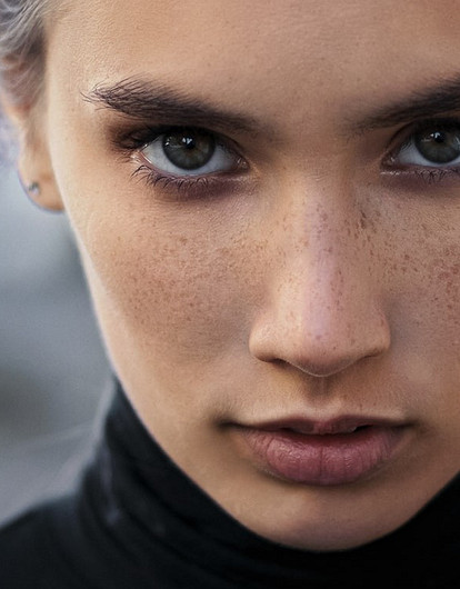 Как убрать пигментацию в домашних условиях или в салоне красоты: 7 реальных способов