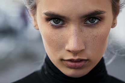 Как убрать пигментацию в домашних условиях или в салоне красоты: 7 реальных способов