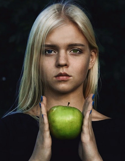 19 признаков весеннего авитаминоза у детей (фото)