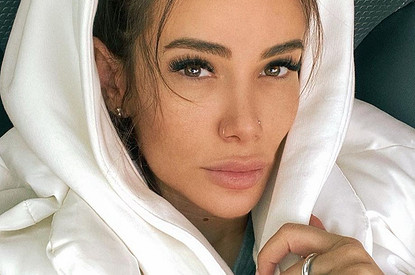 «Брови слишком высоко»: Айза Анохина показала лицо на второй день после подтяжки