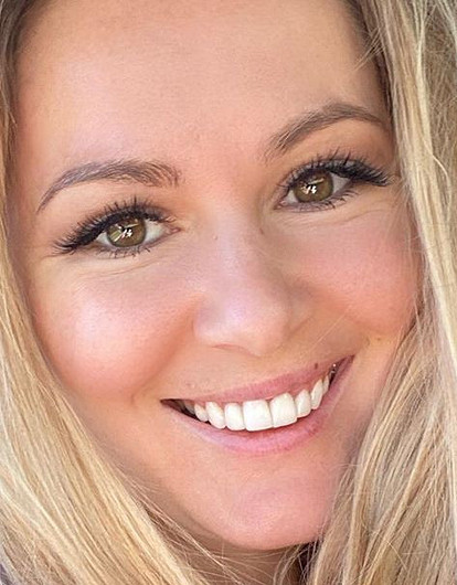 Мария Кожевникова поделилась грустным фото с синяком под глазом (от всех не изолируешься)